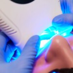 Teeth Whitening In Dental In Upper Roseville Newark NJ